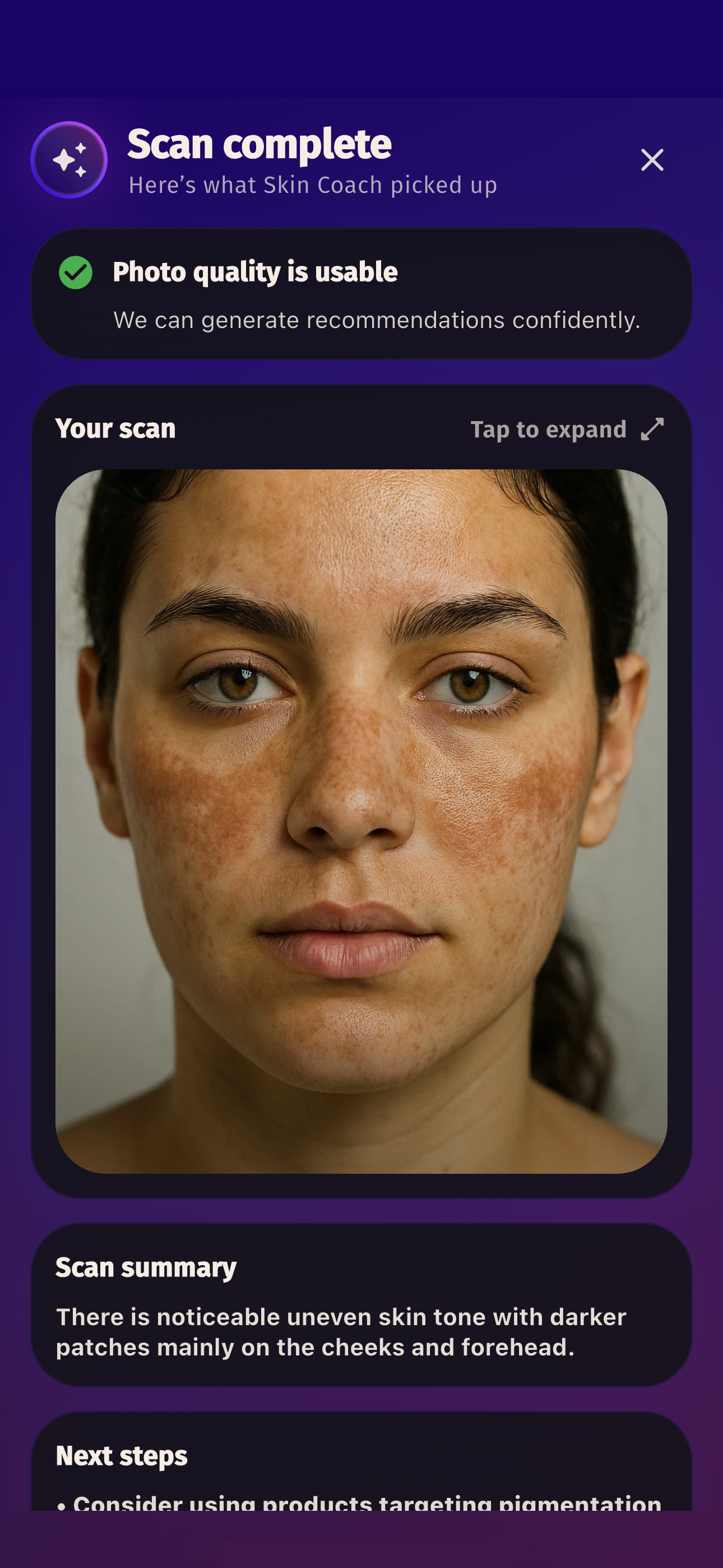 Skincentric scan complete screen showing visible skin insights and next-step guidance.